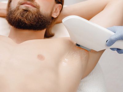 Diode hair and laser removal – Arms (Men)
