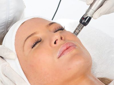 Dermapen Mezolifting