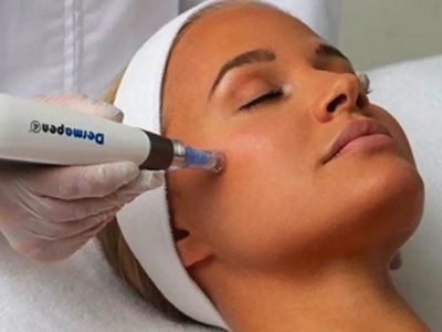 Dermapen Lifting Peel